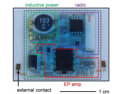 Miniaturized Mobile Health Monitoring (6 of 9)