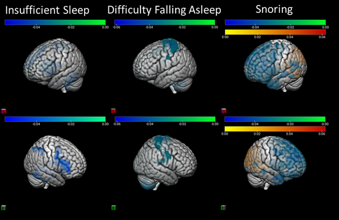 Sleep and brain circuitry