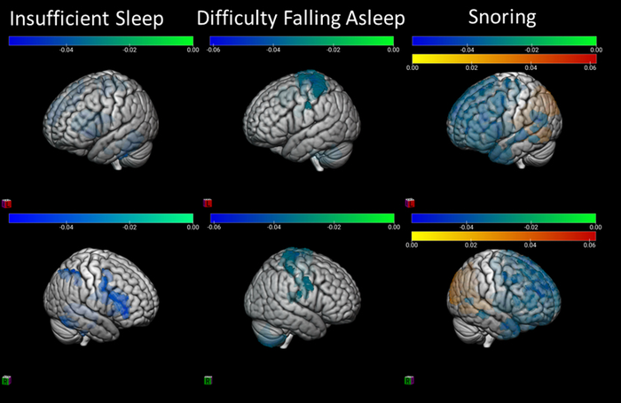 Inadequate sleep is bad for preteens' brains | EurekAlert!