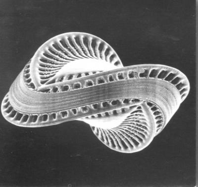 In Diatom Evolution, It Was Green Before Red (3 of 3)