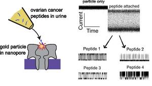 New Method Could Detect Early Ovarian Cancer from Urine Samples