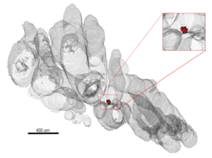 Tumor in Mouse Prostate