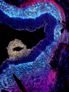 Ovarian follicle at the advanced “antral” growth stage