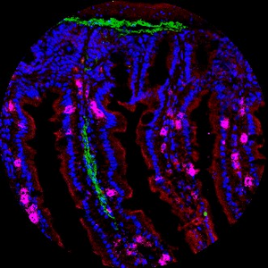 T cells in small intestine