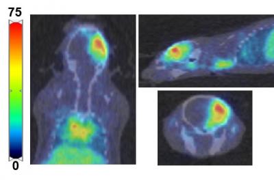 PET Imaging