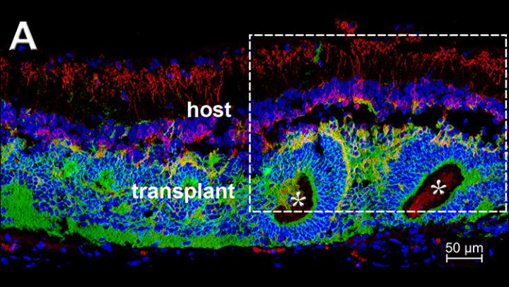 Rod Bipolar Cells