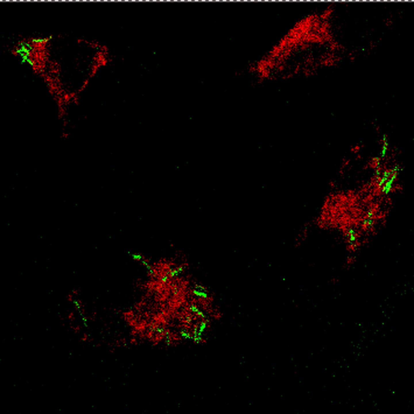 At Long Last, A Urine Test for Accurate Tuberculosis Detection (5 of 6)