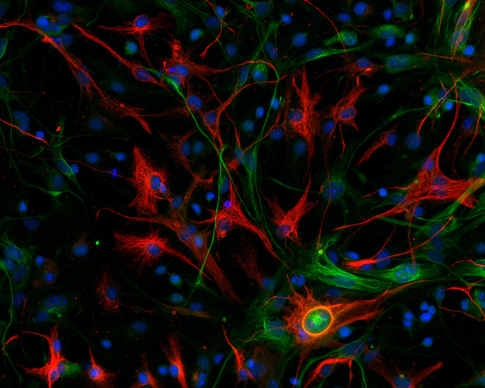 Mouse mesenchymal GBM sample stained for markers of stem cells (green) and differentiated cells (red). /CNIO