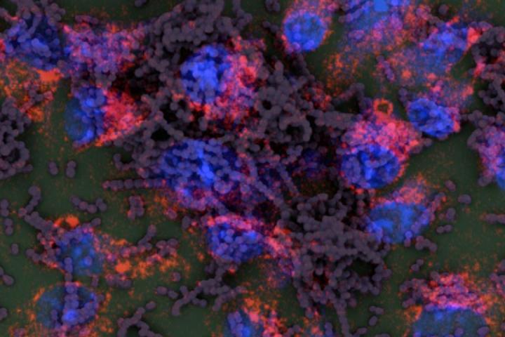 GAS-M1 Macrophages, UC San Diego School of Medicine