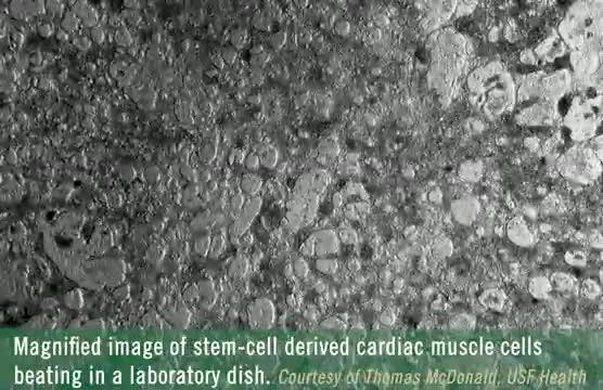 Cardiac cells in a dish