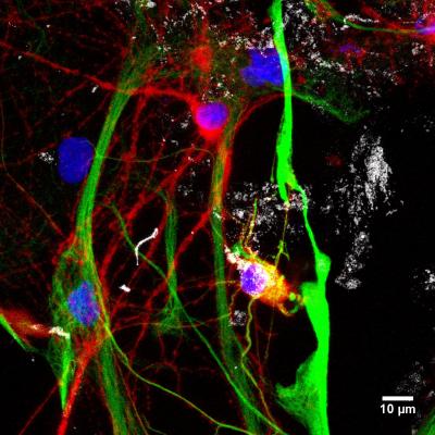 Reconstructions of Hippocampal Cultures 
