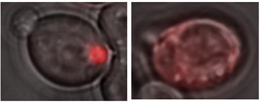 Lsb2-red Fusion Proteins in Yeast
