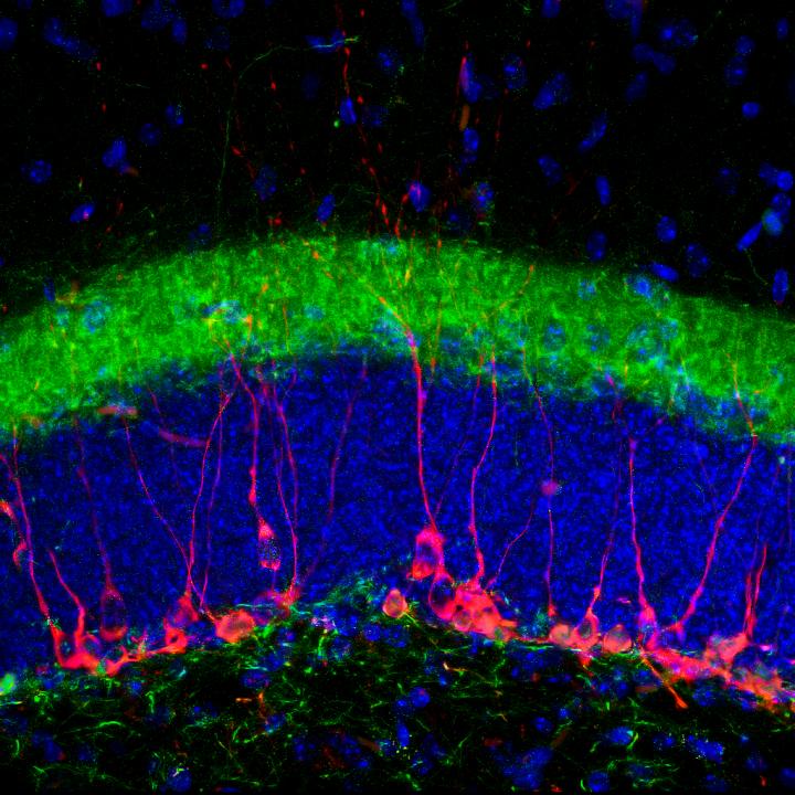 Staining for immature neuronal markers doublecortin (red) and calretinin (green)