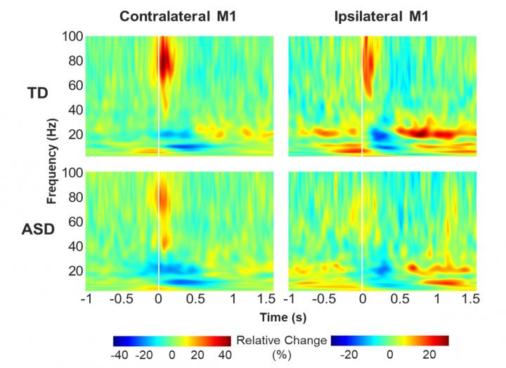 Movement-Related Oscillatory Changes