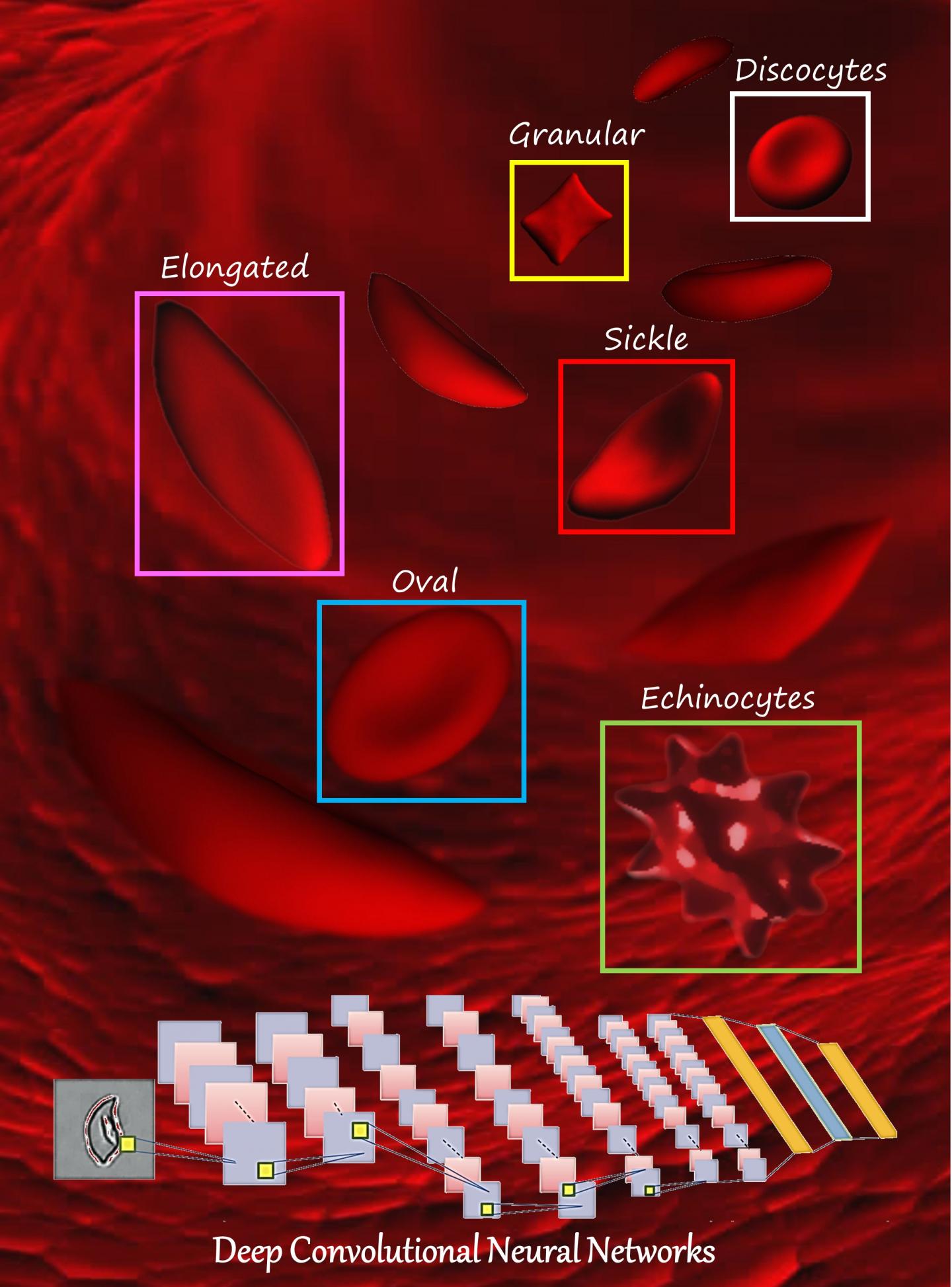 New Machine Learning System Can Automatically Identify Shapes of Red Blood Cells