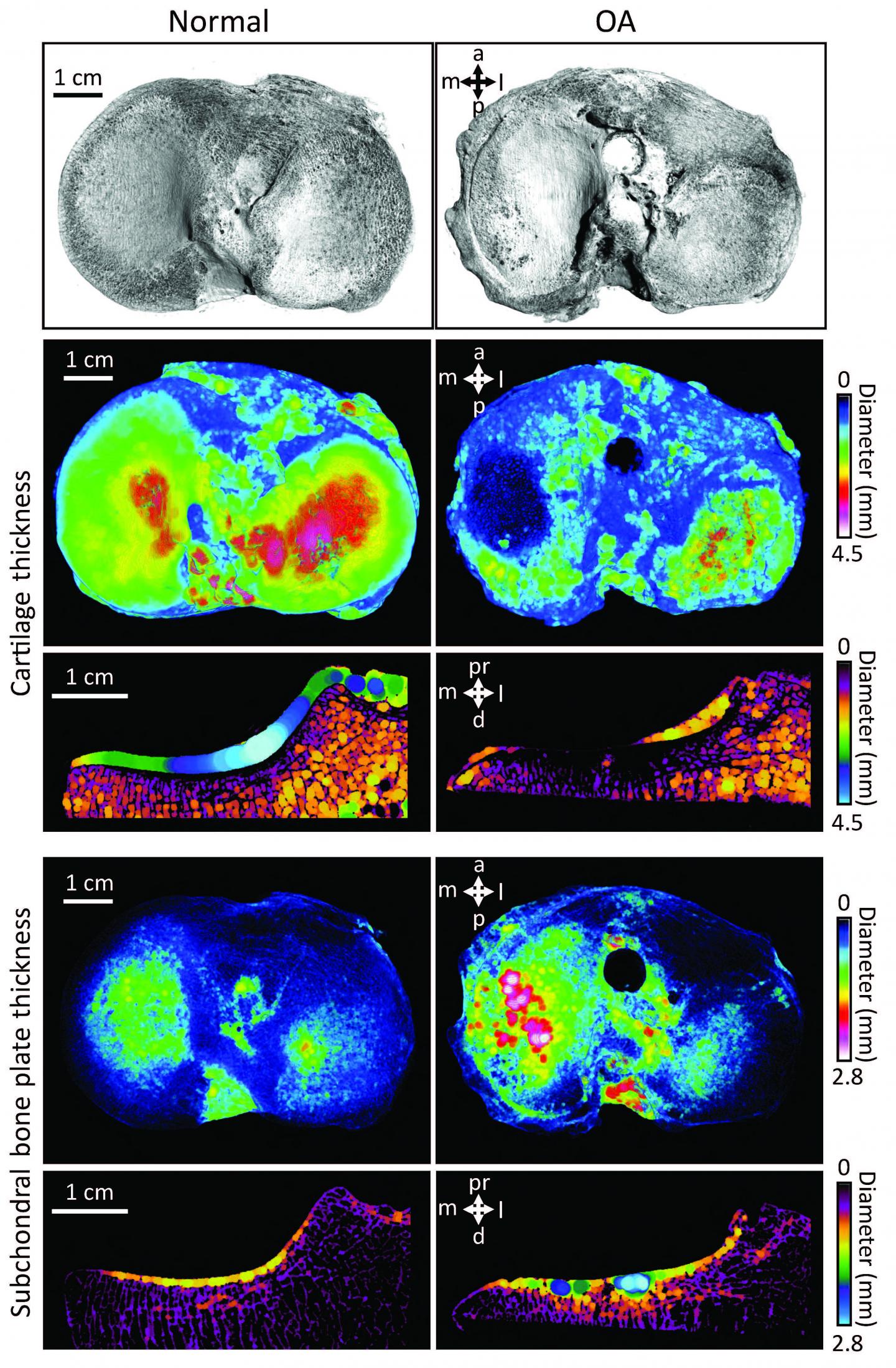 Modeling in Sheep Reveals Secrets of Early Osteoarthritis (1 of 2)