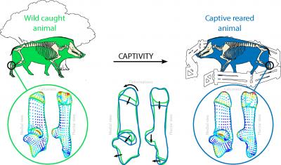 Deformation of the Calcaneus (Tarsal Bone)