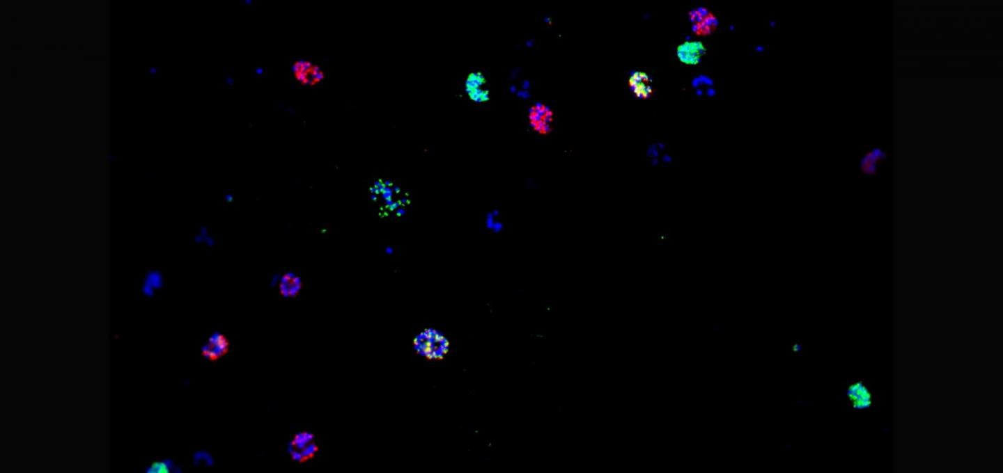 CLAG3 Expression in <em>P. falciparum</em>