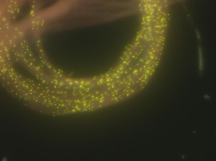 Finding Polyphosphate in Marine Sponges