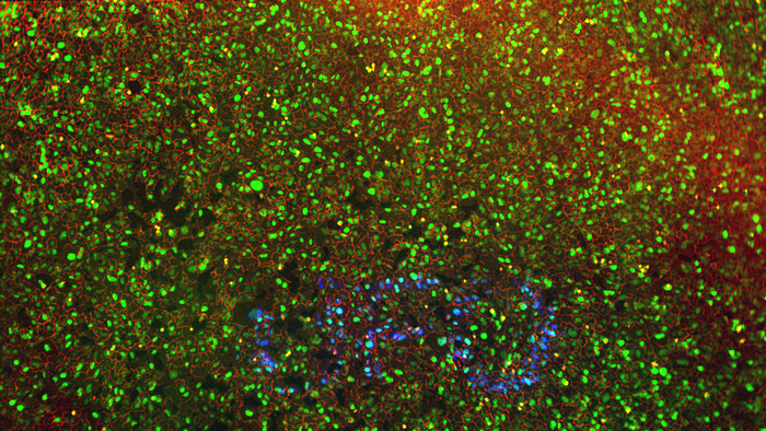 Phototagged cancer cells