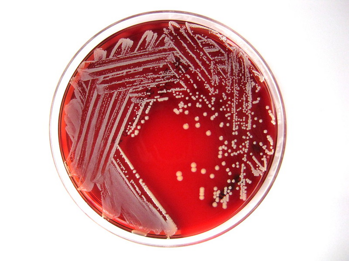 Pediatric Investigation Article Sheds Light on the Virulence of Staphylococcus lugdunensis in Pediatric Populations