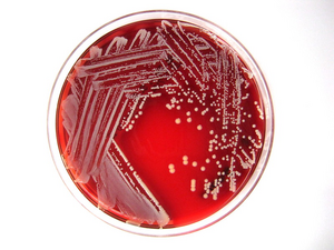 Pediatric Investigation Article Sheds Light on the Virulence of Staphylococcus lugdunensis in Pediatric Populations