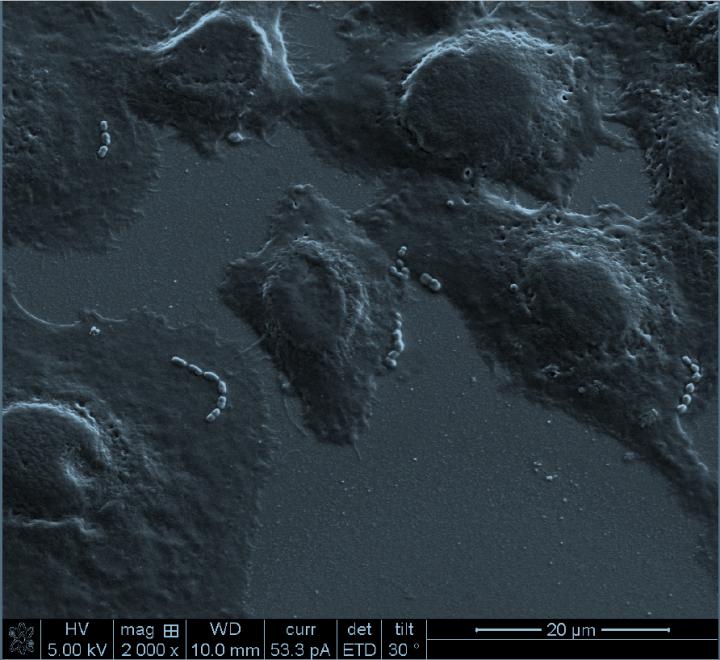 Pneumococci Sticking to Airway Cells