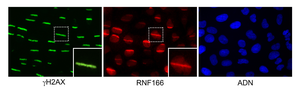 Images of human cells with DNA damaged