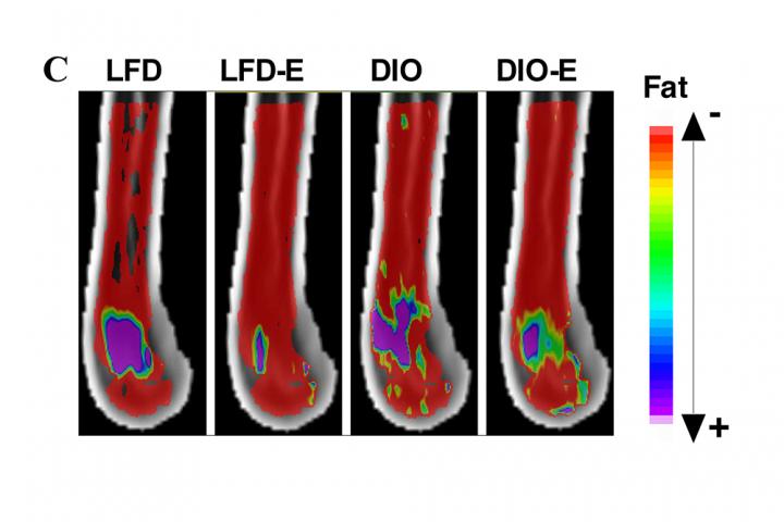 MRI of Bone