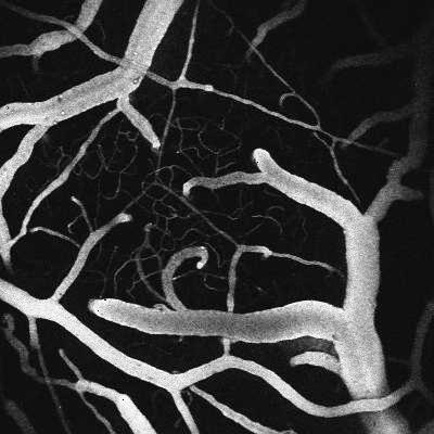 Surface Arteries Brain Dive into the Brain to Feed Capillaries