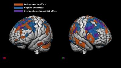 Exercise and brain wiring