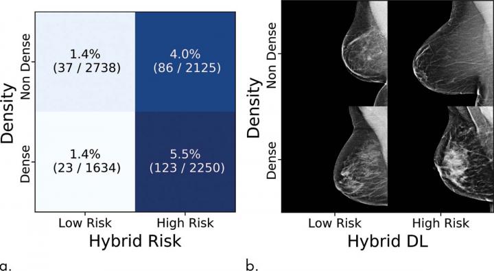 Novel Artificial Intelligence Method Predicts Future Risk of Breast Cancer