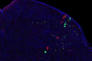 Cells of common origin in the superior colliculus marked by MADM.