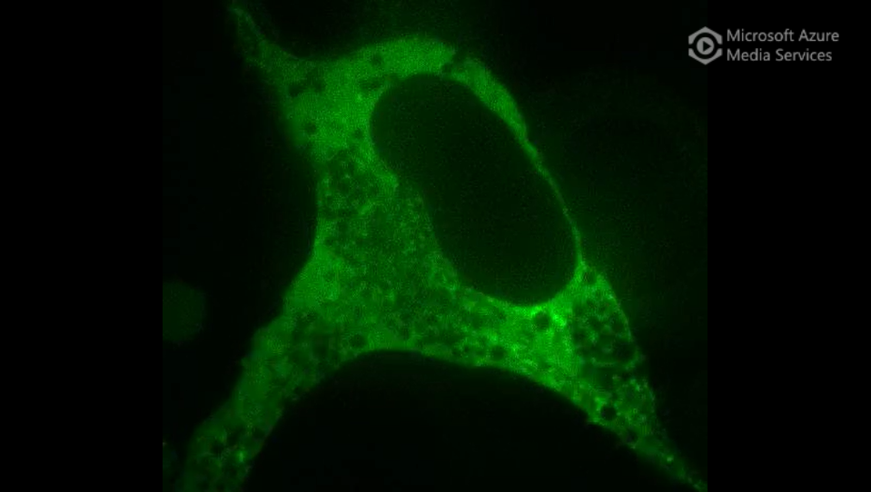 WNKs in Phase Separation