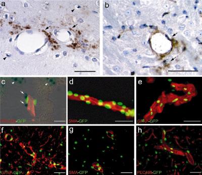 Expression of tPA, PDGF-CC and PDGF-alpha