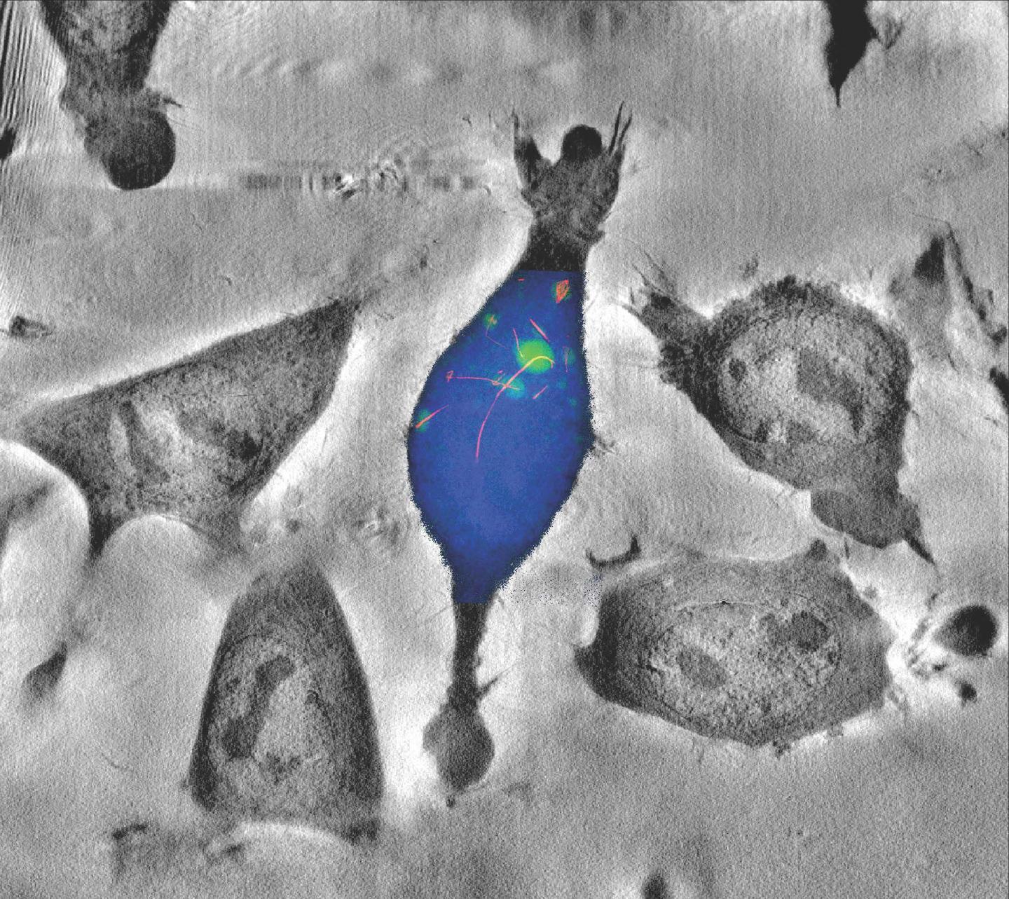 Elemental Distribution within a Single Mouse Fibroblast Cell