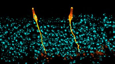 Pulmonary Ionocytes, Mouse Olfactory Neuroepithelium