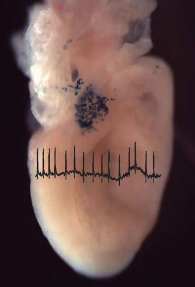 Cellular Source of AF