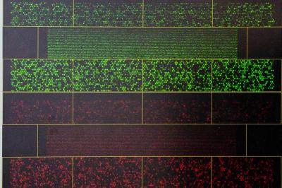 Arthritis Research at University of Manchester