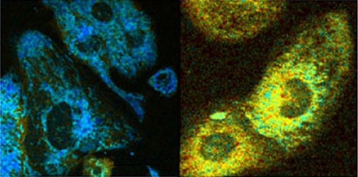 Cell Fluorescence Reveals Metabolic Activity