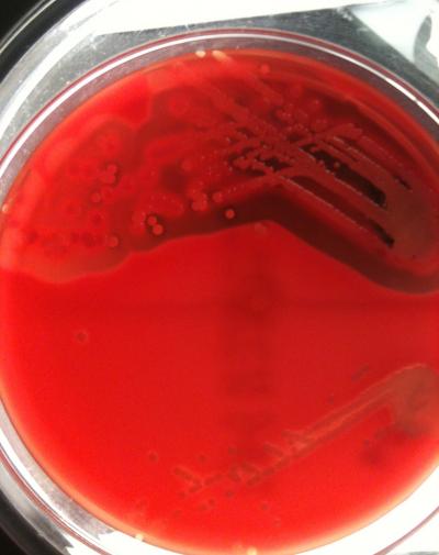 MRSA Genome Predicts Toxicity