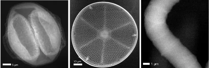 Low-Dose Scanning Compton X-ray Micrographs of Biological Samples