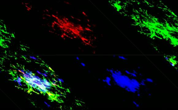 Confocal Images from a C3-Sufficient Mouse Model of Alzheimer's Disease
