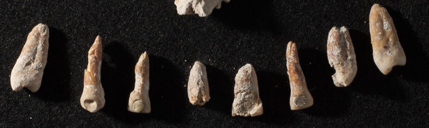 Teeth with dental inlays