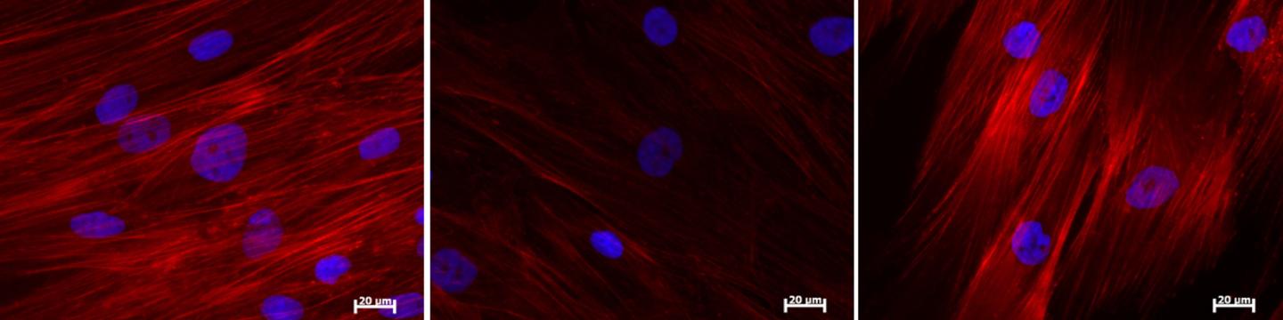 Nanog Reverses Aging in Adult Stem Cells