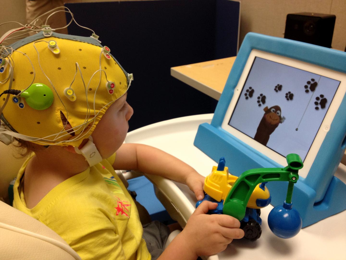 Studying How Cochlear Implants Affect Brain Circuits