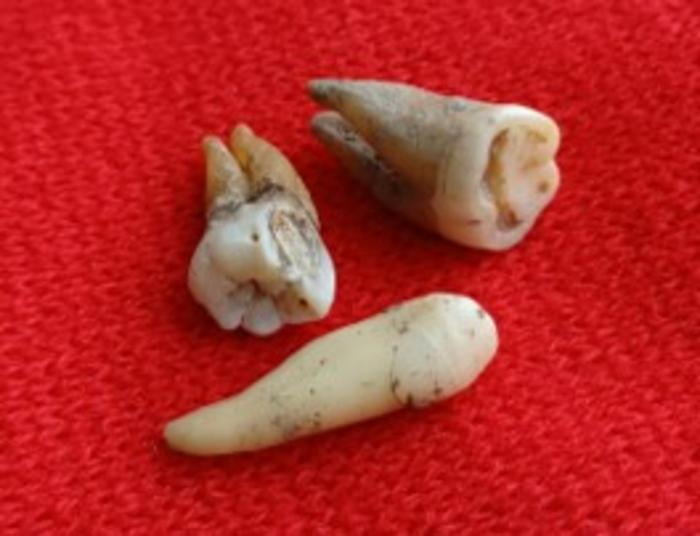 Ancient teeth