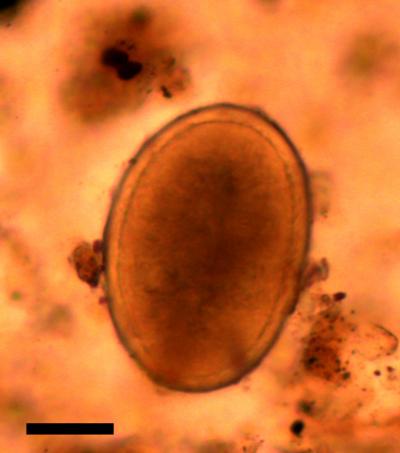 Richard III Roundworm Egg