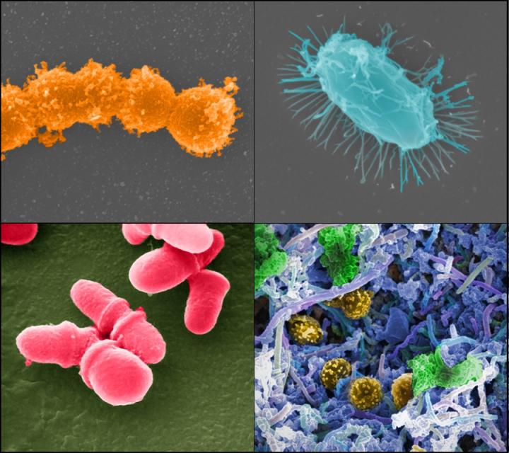 Clockwise from Left: Streptococcus; Microbial Biofilm of Mixed Species in a Human; Bacillus; Malasse