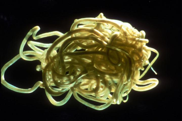 Study Sheds Light on Parasite that Causes River Blindness